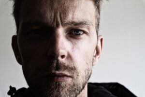 40代で糸リフトを受ける前に知っておくべき後悔ポイントは？